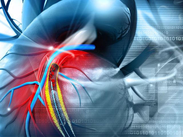 Фото Уніан