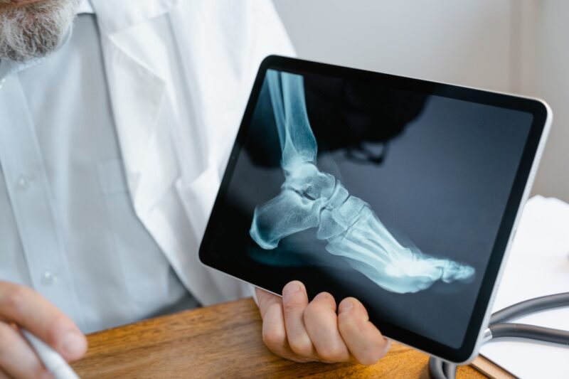 x ray рентген
