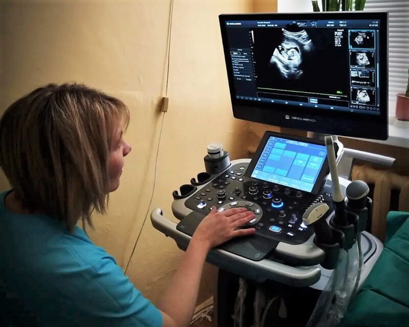 Шосткинський пологовий отримав УЗД-апарат з 3D/4D-можливостями
